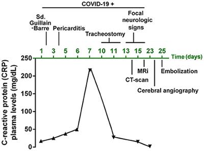 Case report: Endovascular embolization of a cerebral pseudoaneurysm caused by SARS-CoV2 infection